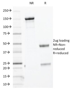 Cytokeratin, HMW Antibody (KRTH/1076), Novus Biologicals 0.2mg; Unlabeled:Antibodies,
